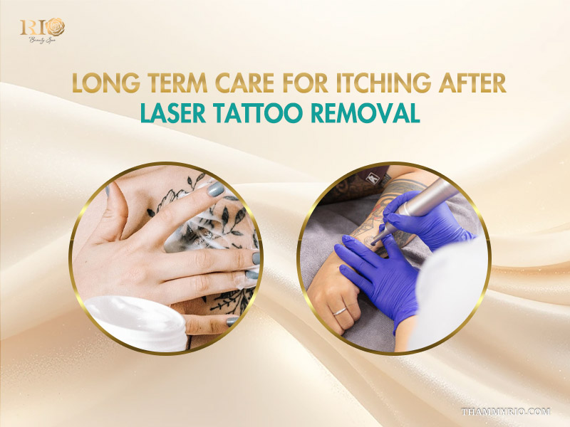 Long term skin care process to manage tattoo removal itchy symptoms after laser treatment.
