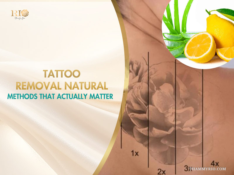 A comparison of tattoo removal natural methods using aloe vera and lemon to fade ink over multiple sessions.