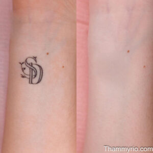 This promotional graphic from Rio Beauty Spa features two panels labeled "before" and "after". The left side displays a black vine and leaf tattoo on the wrist, while the right side shows the skin completely clear, illustrating the effective transformation through professional tattoo removal on wrist.