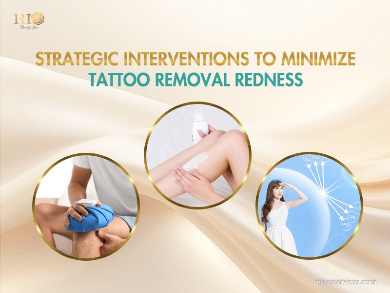 Strategic interventions including cold compress, moisturizing, and sun protection to minimize tattoo removal redness.