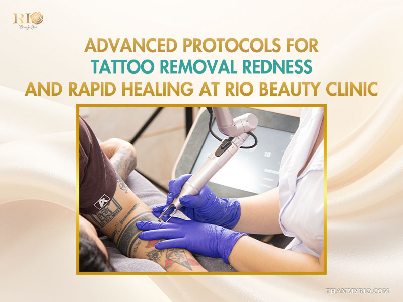 Professional laser treatment session using advanced protocols to manage tattoo removal redness and promote rapid healing.