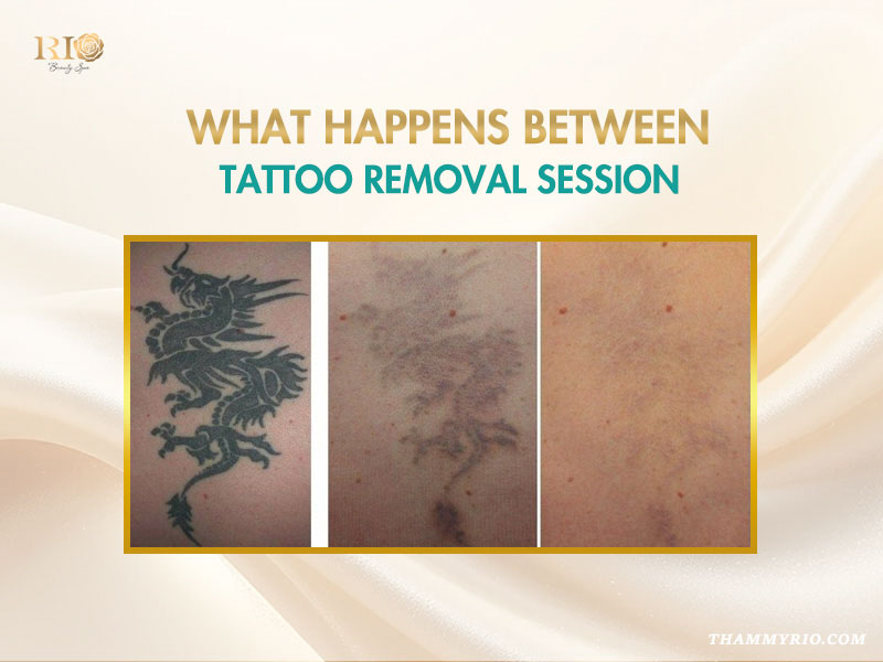 Before and after comparison of a dragon tattoo fading after each tattoo removal session.