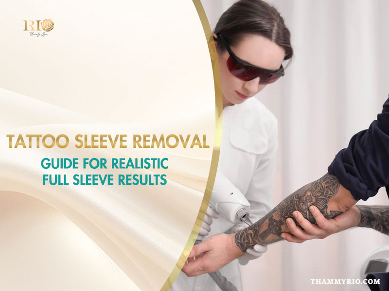 Professional tattoo sleeve removal process using advanced laser technology at Rio Beauty Spa