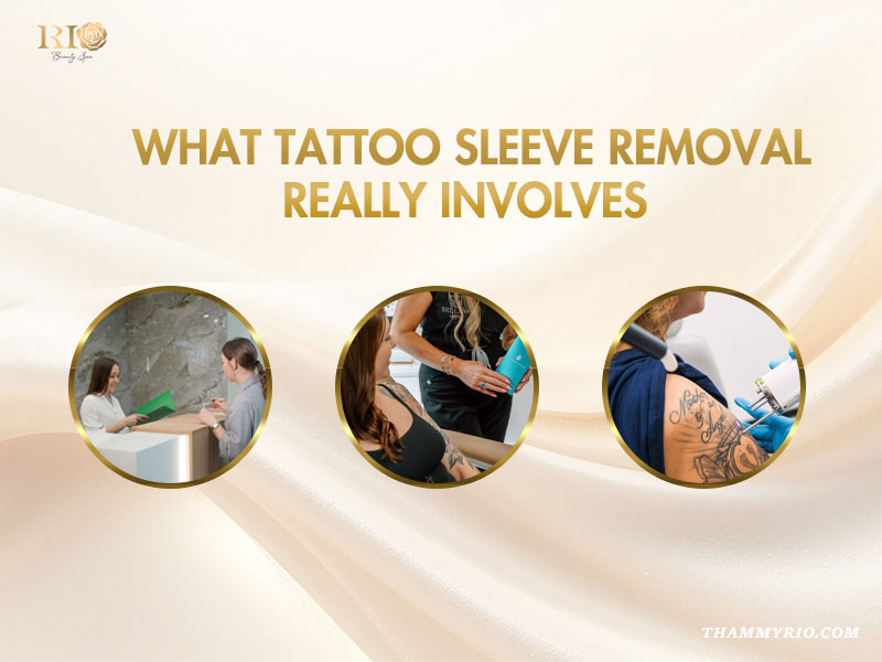 Professional tattoo sleeve removal process at Rio Beauty Spa showing consultation and laser treatment steps.