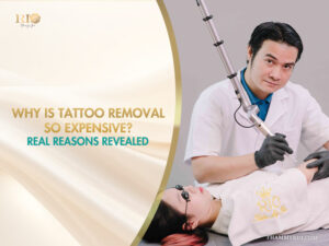 Professional laser tattoo removal procedure at Rio Beauty Spa explaining why is tattoo removal so expensive.