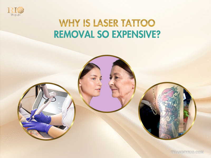Infographic explaining why is laser tattoo removal so expensive featuring clinical equipment and professional results.