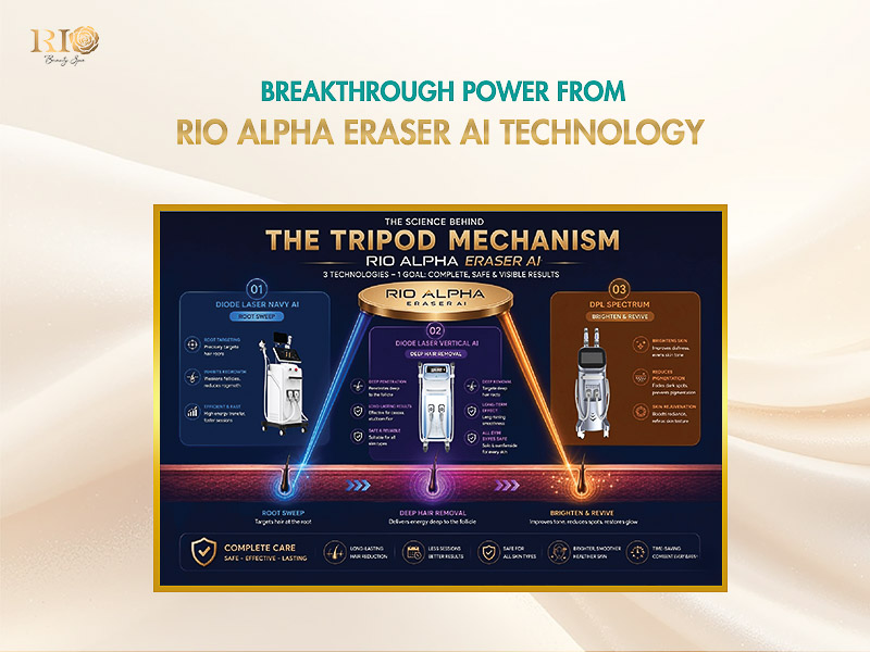DPL Spectrum Laser: An essential technology in the Rio Alpha Erase AI system at Rio Beauty Clinic.