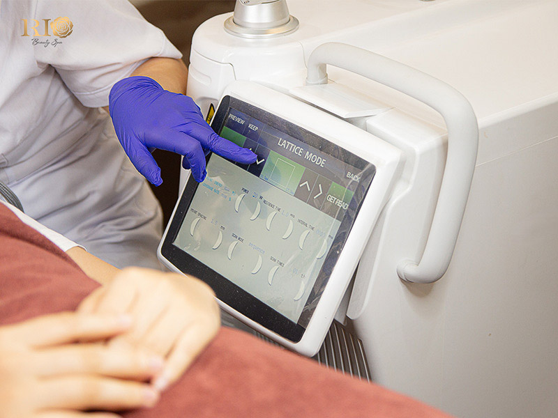 Navy Ai Diode Laser technology featuring AI-guided hair follicle detection and deep cooling for painless results.