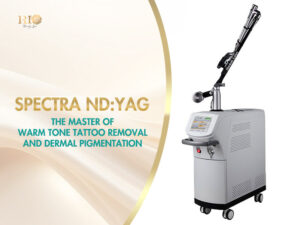 ND Yag Spectra laser system, a critical component of the Rio Laser Ultra Series for medical-grade tattoo removal at Rio Beauty Clinic.