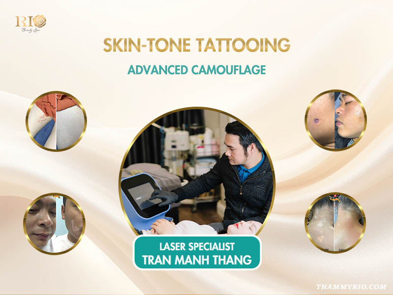 Rio Laser Ultra Series: The Ultimate Triple-Laser Synergy Technology for Clean Removal - Thẩm Mỹ Rio Beauty Clinic