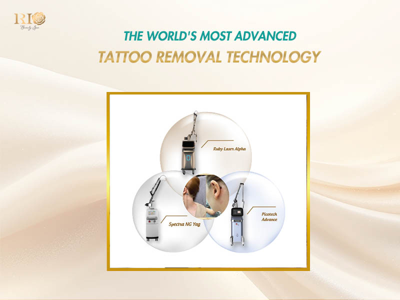 Infographic of Rio Laser Ultra Series combining Picotech Advance, ND YAG Spectra, and Ruby Laser Alpha 6 for flawless skin.