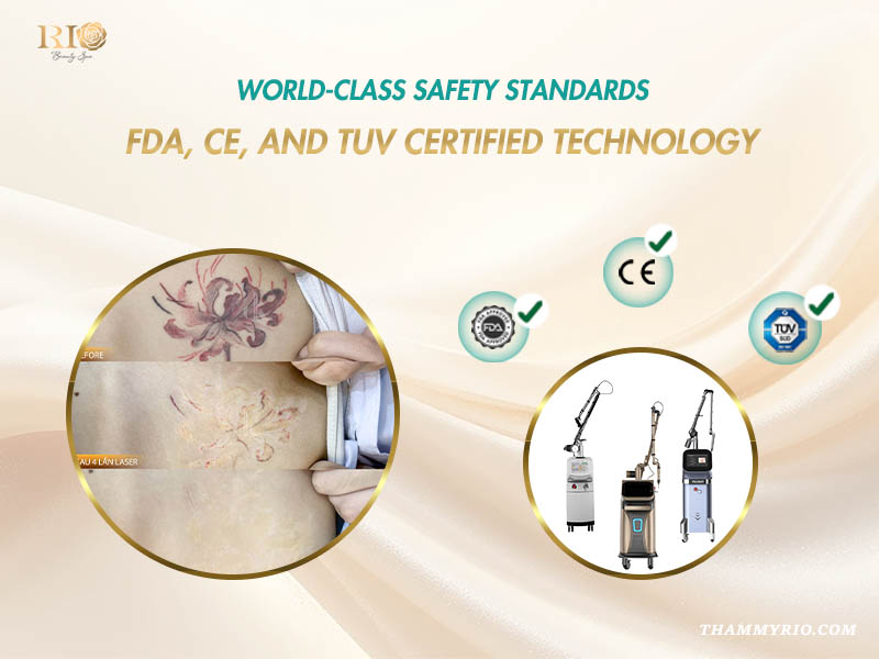 Rio Laser Ultra Series: The Ultimate Triple-Laser Synergy Technology for Clean Removal 1 - Thẩm Mỹ Rio Beauty Clinic