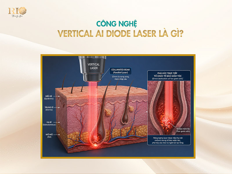 Công nghệ Vertical AI Diode Laser với phần cứng y tế và phần mềm AI độc quyền mang lại hiệu quả triệt lông vượt trội.