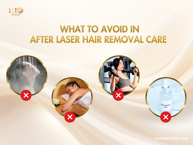 Four things to avoid for after care for laser hair removal including hot showers, sauna, gym, and acids.