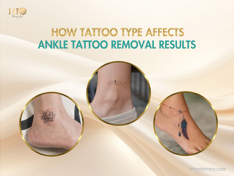 A detailed guide on how different ink types affect ankle tattoo removal results, showcasing text and lotus tattoos.