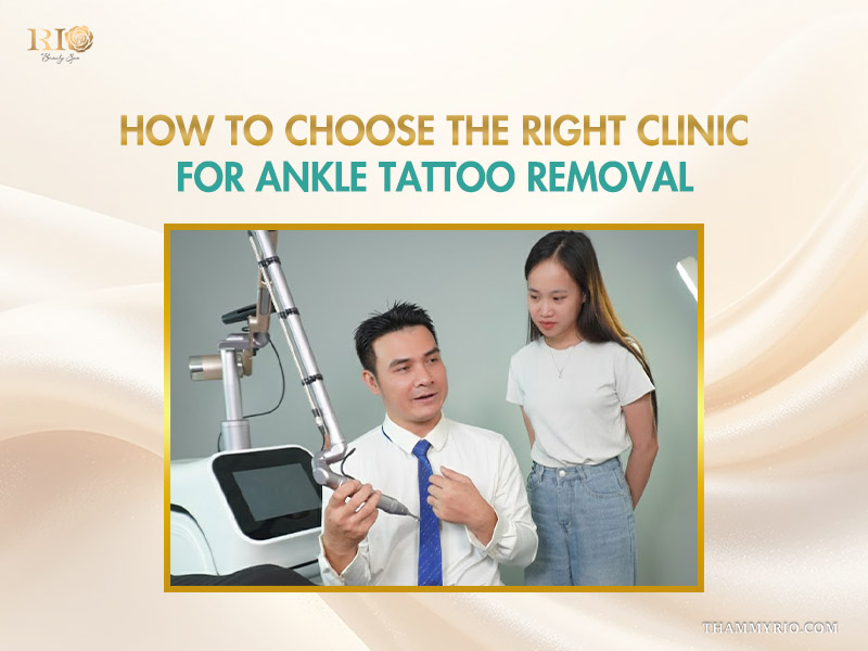 Expert consultation for ankle tattoo removal featuring a professional technician and advanced laser equipment at Rio Beauty Spa.