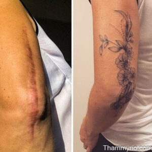 Arm lift tattoo cover up showing a floral black and grey ink design over a long surgical scar on the arm.