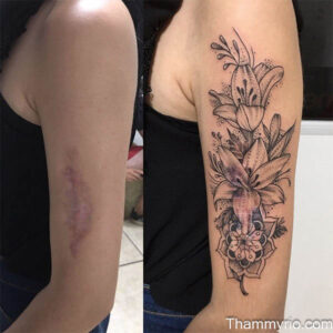 Before and after arm lift tattoo cover up on an upper arm featuring a large lily and mandala floral design.