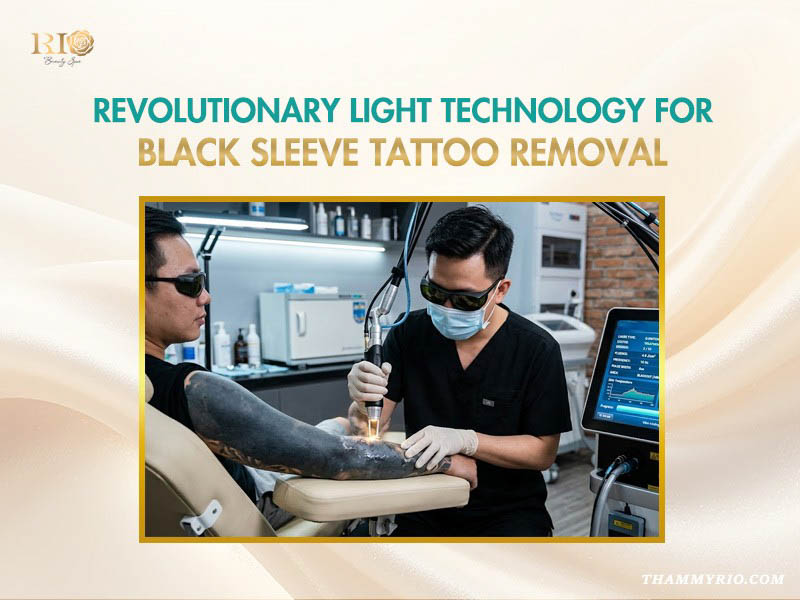 Professional technician performing blackout tattoo removal on a client's full black sleeve using revolutionary laser light technology.