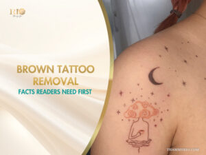 Professional brown tattoo removal service featuring a delicate moon and stars tattoo on a shoulder.