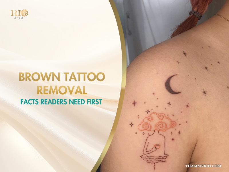 Professional brown tattoo removal service featuring a delicate moon and stars tattoo on a shoulder.
