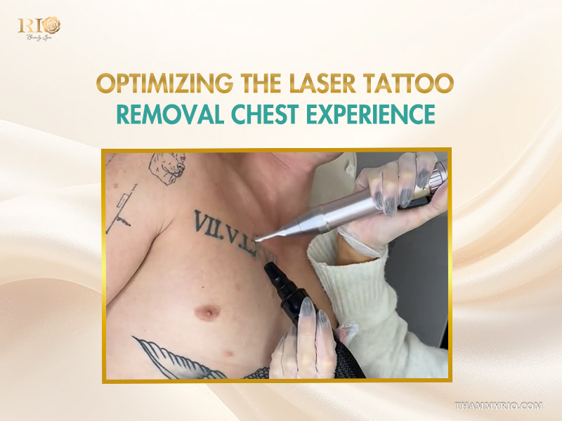Laser chest tattoo removal session on Roman numeral ink at Rio Beauty Spa.