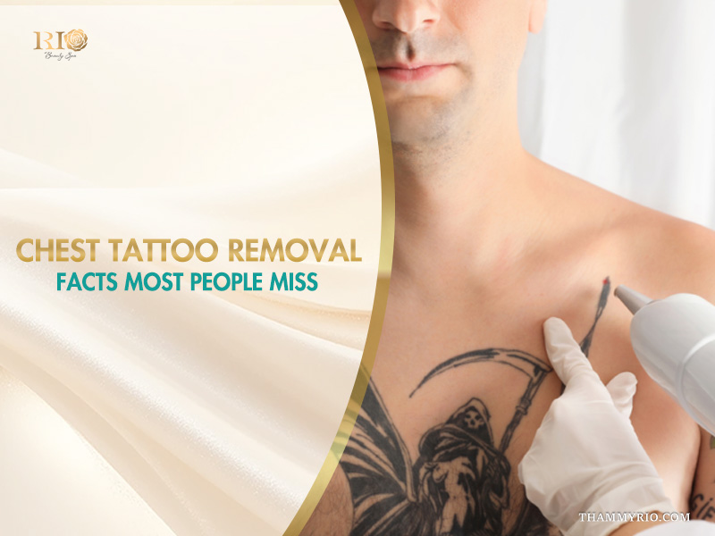 Laser chest tattoo removal of a Grim Reaper design at Rio Beauty Spa.