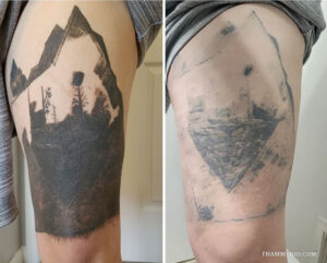 Dark tattoo removal before and after showing faded mountain landscape