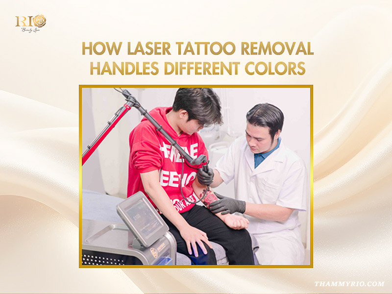 Professional laser technician performing a procedure to target the easiest tattoo color to remove on a client's arm.