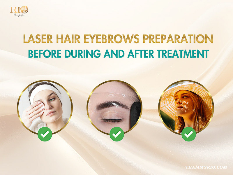 Essential preparation steps before during and after an eyebrow laser hair removal treatment session.