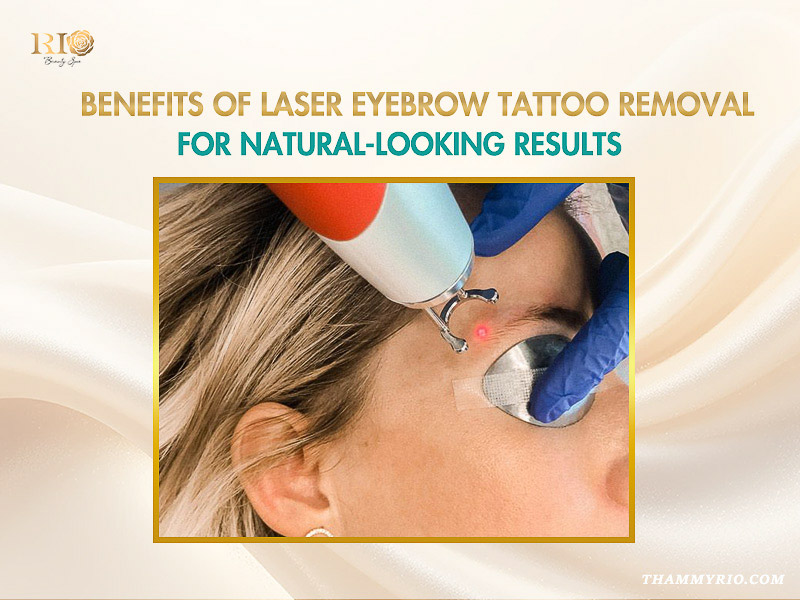 Laser eyebrow tattoo removal treatment at Rio Beauty Spa for natural looking results.