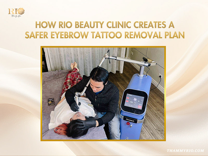 A specialist performing laser eyebrow tattoo removal using Picotech technology at Rio Beauty Clinic.