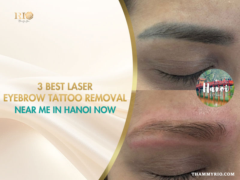 Laser eyebrow tattoo removal near me in Hanoi at Rio Beauty Spa before and after results.