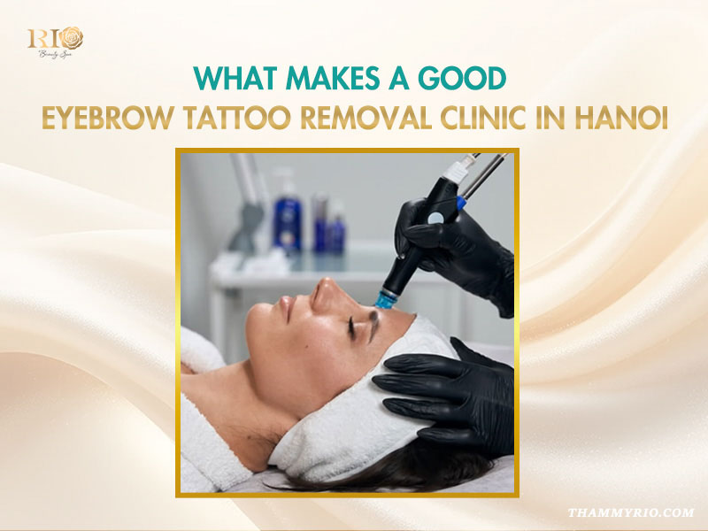 Professional laser eyebrow tattoo removal near me in Hanoi performed at Rio Beauty Spa.