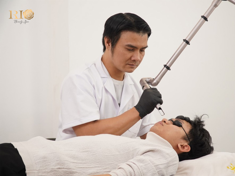 Professional laser eyebrow tattoo removal near me in Hanoi for men at Rio Beauty Spa.