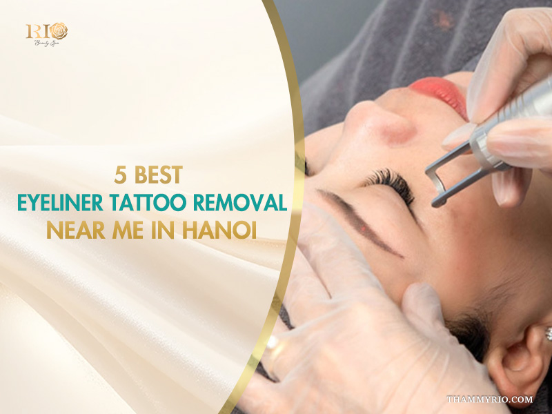 5 best eyeliner tattoo removal near me in Hanoi