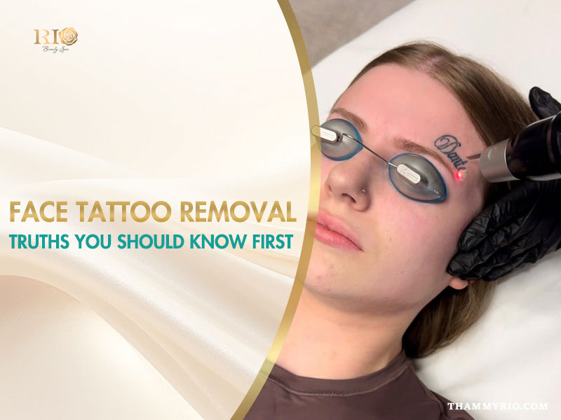 Professional laser face tattoo removal procedure on a woman's forehead at Rio Beauty Spa.