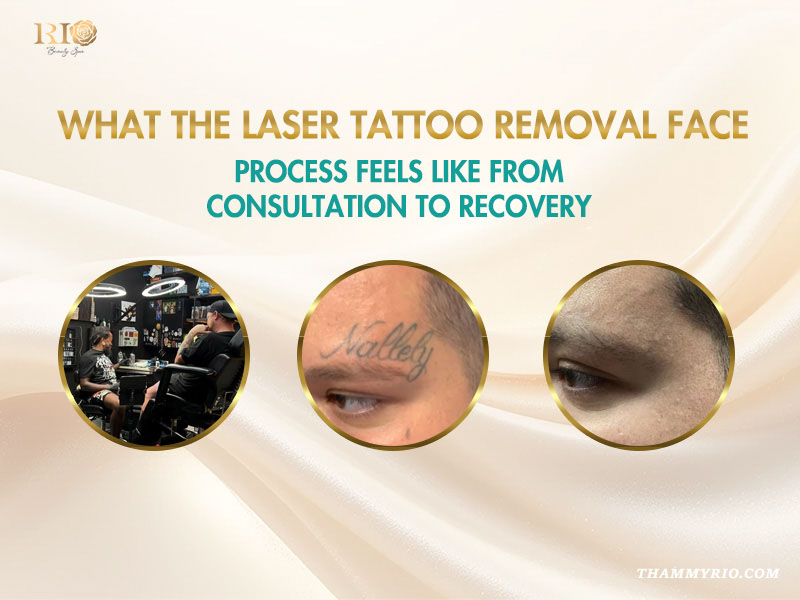 A detailed infographic of the professional laser face tattoo removal process, from consultation to the before-and-after results of fading a forehead tattoo.