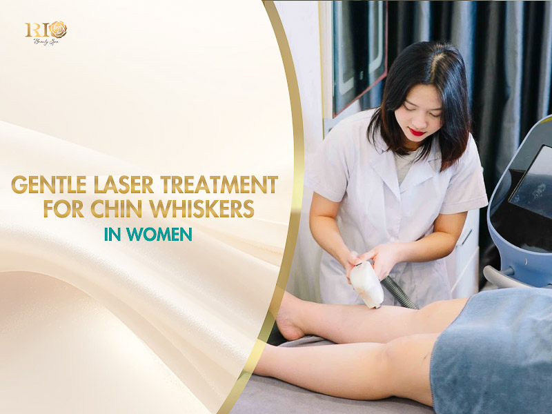 Advanced laser device treating hair on chin for females inside a luxury treatment room at Rio Beauty Clinic.