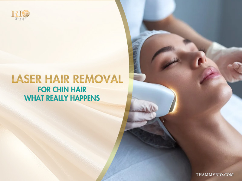 A female client receiving laser hair removal for chin hair treatment from a specialist at Rio Beauty Clinic
