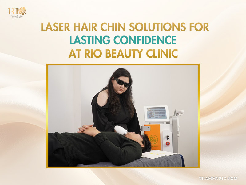 A practitioner performing laser hair removal for chin hair on a male client lying down at Rio Beauty Clinic