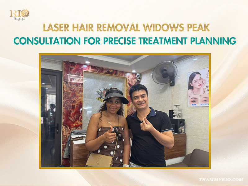 Laser hair removal widows peak consultation with a specialist at Rio Beauty Clinic for a precise hairline treatment plan.