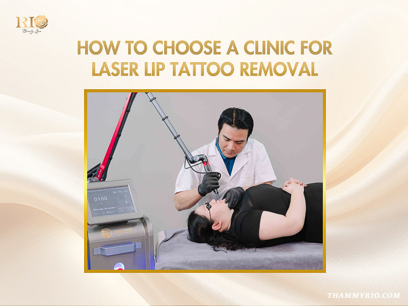 A professional specialist performing a laser lip tattoo removal treatment on a female patient.