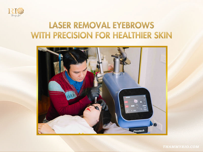 Expert performing laser removal eyebrows with precision technology at Rio Beauty Spa.