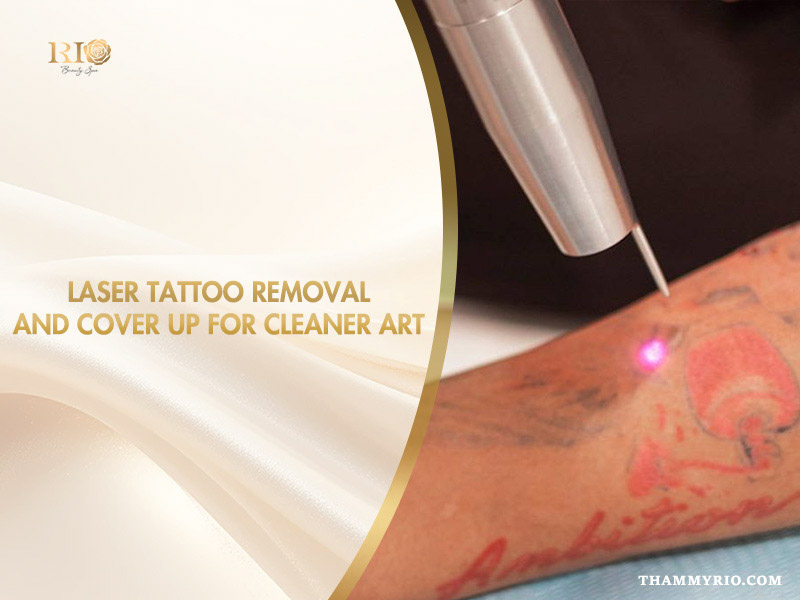 Professional laser tattoo removal and cover up process at Rio Beauty Spa.