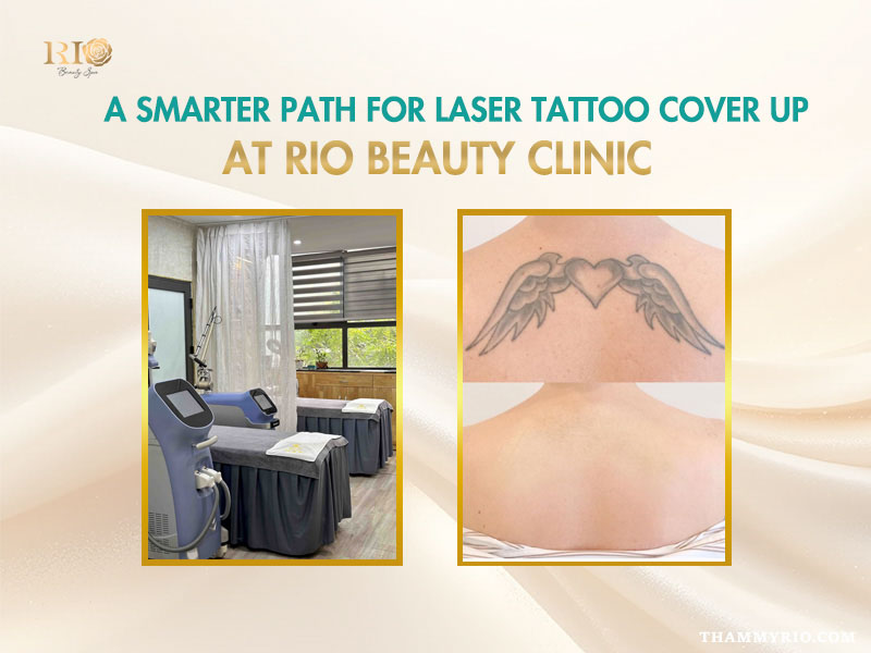 Professional laser tattoo removal and cover up treatment at Rio Beauty Clinic.