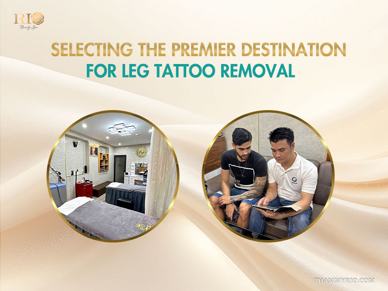 Professional consultation for leg tattoo removal at Rio Beauty Spa showing the clinic interior and expert advice.