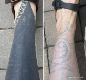 Before and after comparison of dense black leg tattoo removal, showing significant fading of a large geometric pattern to reveal underlying details.