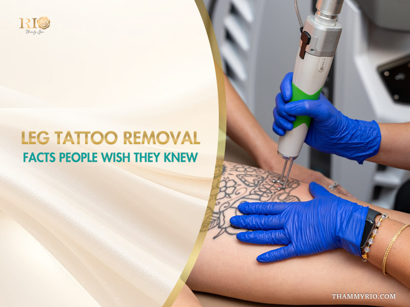 Professional laser leg tattoo removal procedure at Rio Beauty Spa featuring a large thigh tattoo being treated.
