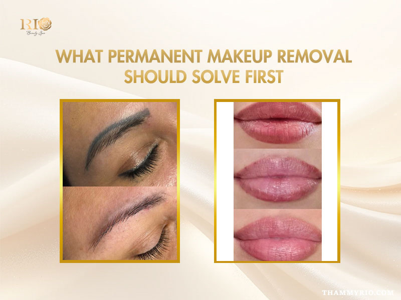 Before and after results of permanent makeup removal for saturated eyebrows and uneven lip liner.
